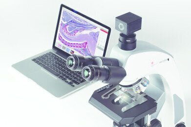 第二代光学显微镜问世