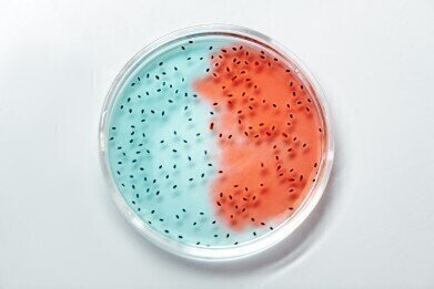 食品中细菌-类型,测试与问题